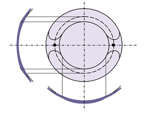 Torisch dynamische Stabilisation