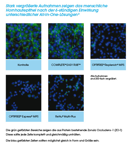 Hornhautepithel Multifunktionslösungen