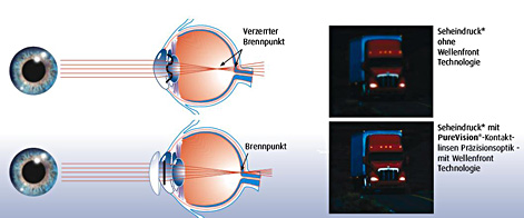 PureVision HD Qualit&auml;t