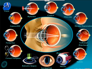 OCUTOUCH Kundeninformation