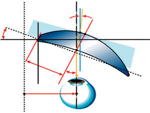 Prismatischer Fehler