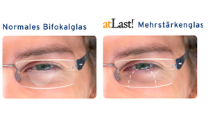atLast Bifokalglas