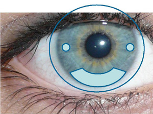 Innentorisch Ballast