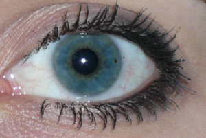 hohes Oberlid tiefes Unterlid