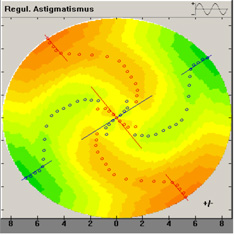 Fourier wirbelf&ouml;rmig