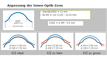 Anpassung der Innenoptikzone
