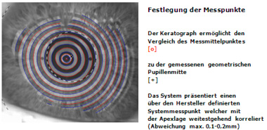 Bezugspunkte zur Messung der Dezentration
