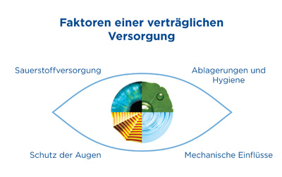 Faktoren verträgliche Kontaktlinsenversorgung