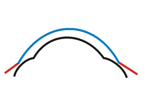 Optikzone Kontaktlinse zu gross