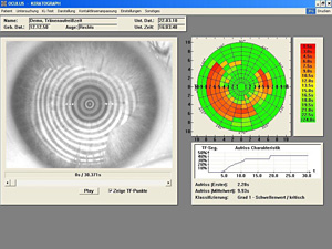 TF Scan