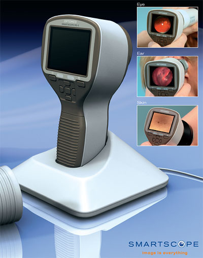 Smarstscope M5