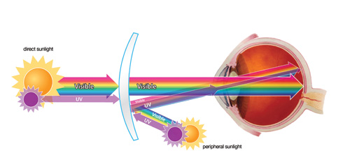 UV Strahlen Reflexion Auge