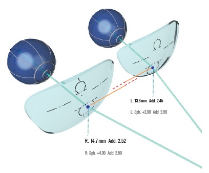 Korrektur von visuellen Ungleichgewichten