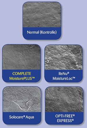 Cornea Hornhaut Kontaktlinsenpflegemittel