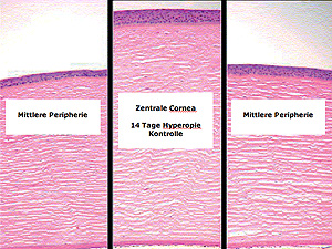 Orthokeratologie Epithelzellen