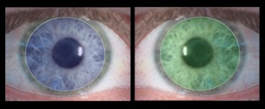 Monovision