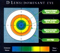 Dominantes Auge