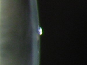 Jelly Bump