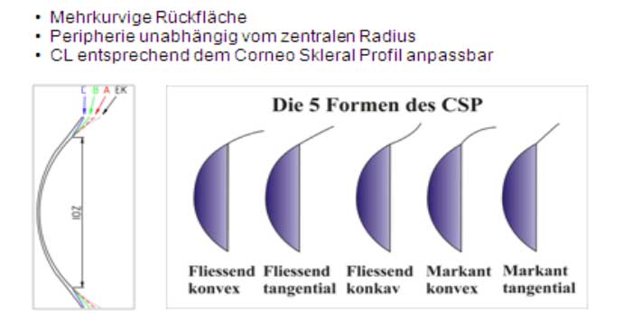 Corneo Skleral Profil