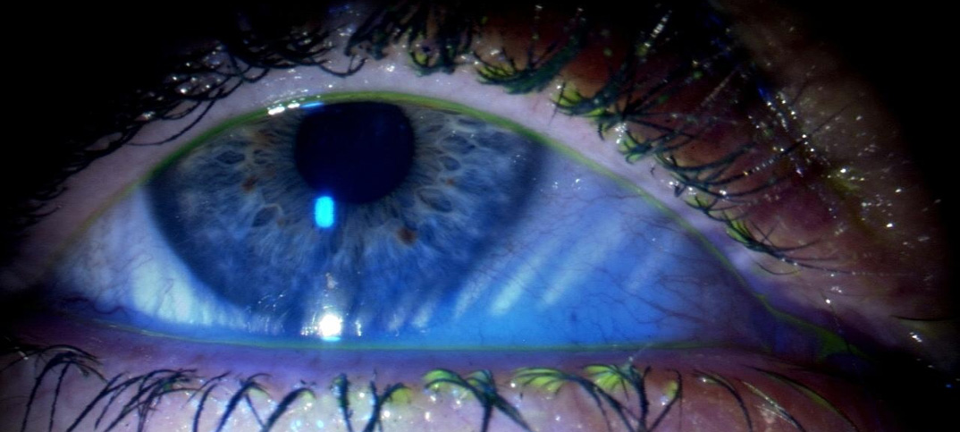 Liposomensprays gegen trockene Augen