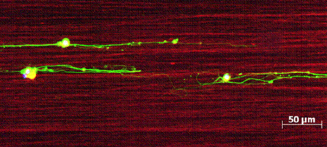 Leipziger Forscher entwickeln Biomaterial