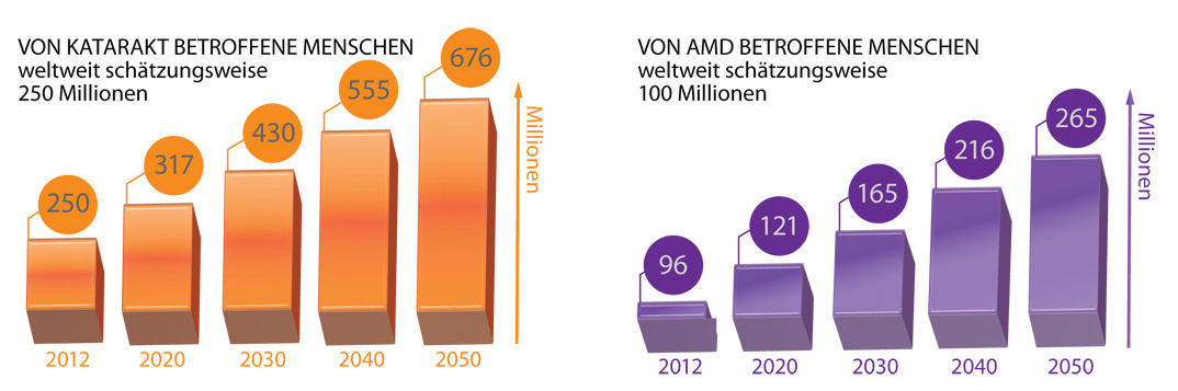 Zunahme von AMD und Katarakt