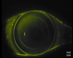 OD Fluo zentral