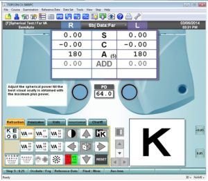 Topcon_CV_5000_2