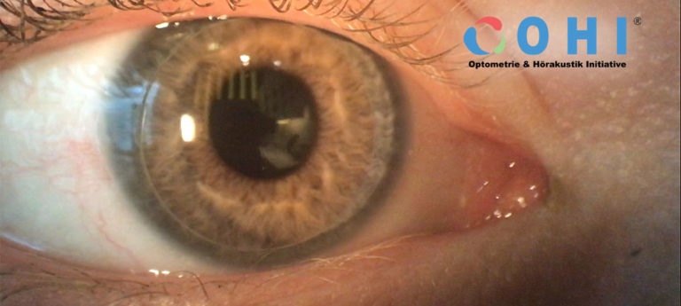 OHI Zweitages Intensivseminar Kontaktlinsen Assistent_in