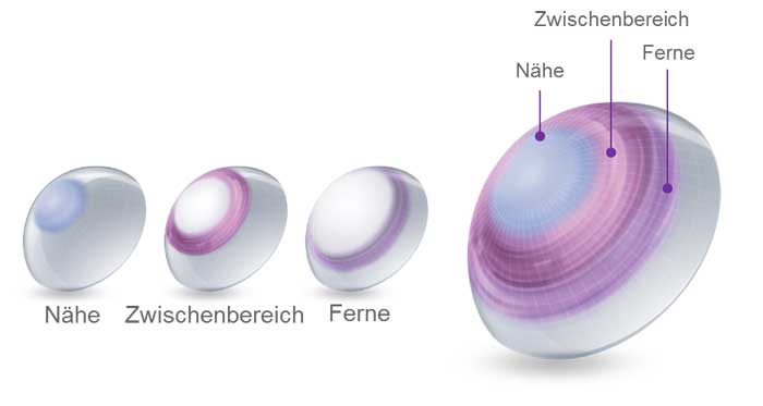 Das bewährte Linsendesign der AIR OPTIX® plus HydraGlyde® MULTIFOCAL mit zentralem Nahbereich arbeitet synergetisch mit der natürlichen Pupillenfunktion