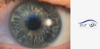 EurOk unterstützt bei Orthokeratologie und Myopiekontrolle