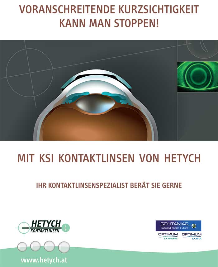 „Wir werden am 11. Juni 2022 beim OHI MYOPIE-KONGRESS zeigen, was sich mit und bei der KSI getan hat, um diese Kontaktlinse noch mehr als bisher als wichtige Option anzubieten“, erklärt Michael Klingbacher, Marketing und Vertrieb Österreich.