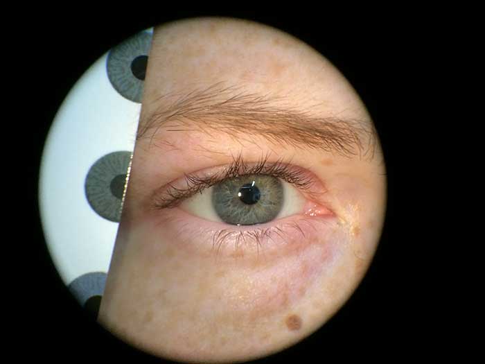 Abgleich des Irisdurchmessers, Pupillendurchmessers und Irisfarbe mittels verschiedener Schablonen