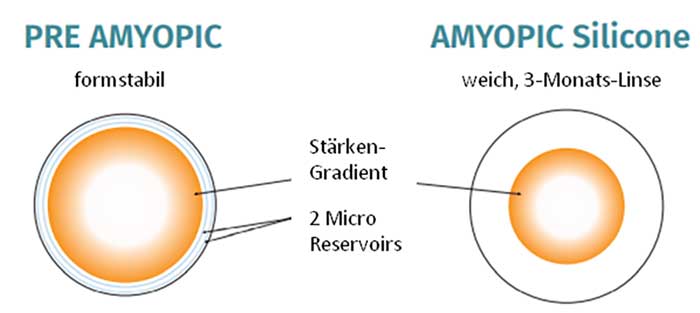 Die Pre Amyopic bedient sich außerdem der Geometrie der DRL und besitzt zwei Micro-Reservoirs